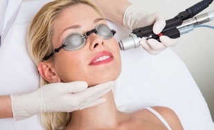 ¿Cómo se realiza el procedimiento de rejuvenecimiento cutáneo facial con láser 