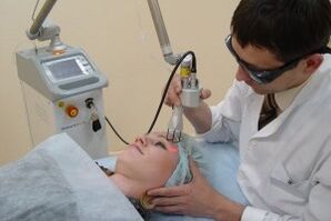 procedimiento de rejuvenecimiento de la piel facial con láser